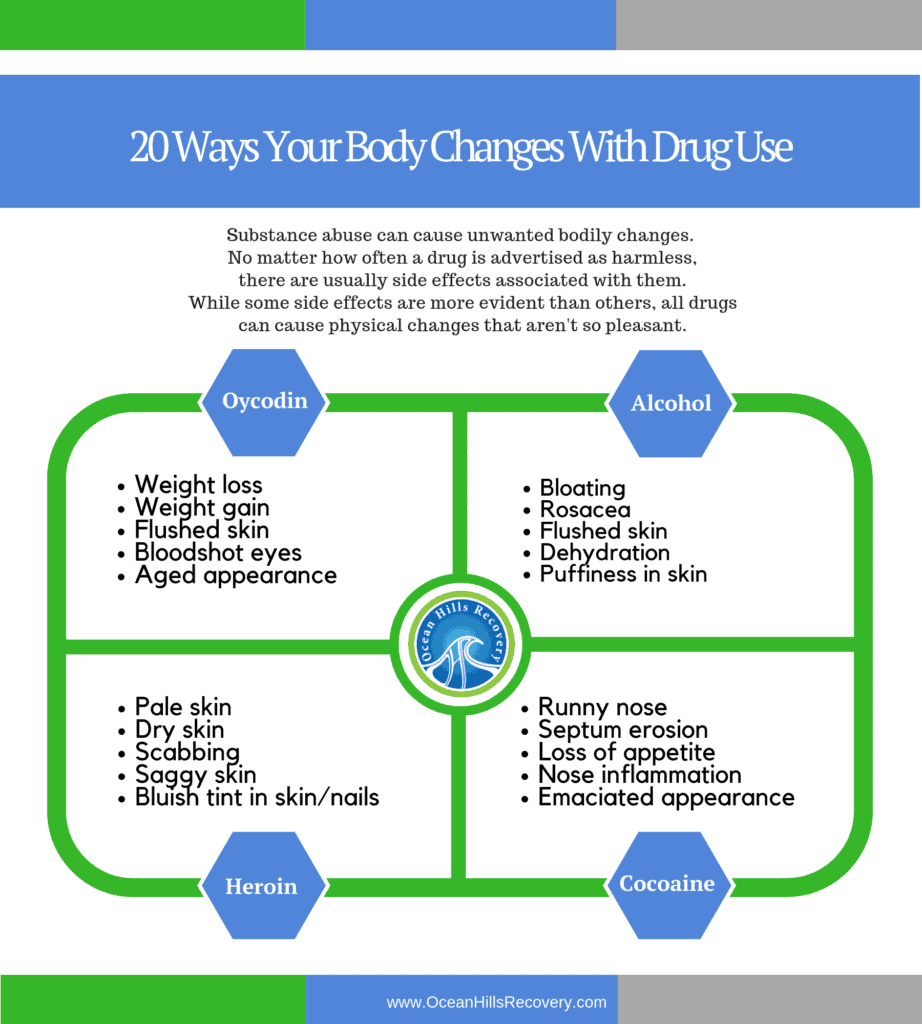 How Your Face Changes Before And After Drugs - Ocean Hills Recovery